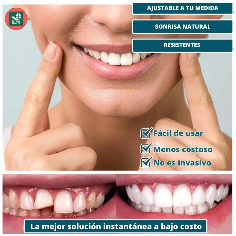 CARILLAS DENTALES
